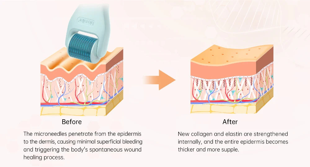 10 In 1 Dermarool Multifunction Microneedle Kit Face Massager